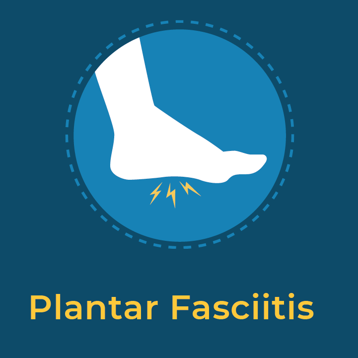 Plantar-fasciitis-icon