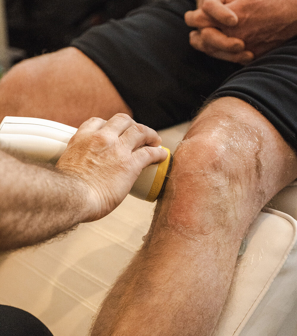 SHOCKWAVE THERAPY FOR KNEE PAIN