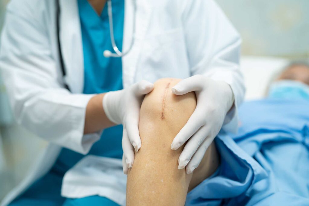 Knee Replacement Surgery: Benefits, Risks, and Alternatives