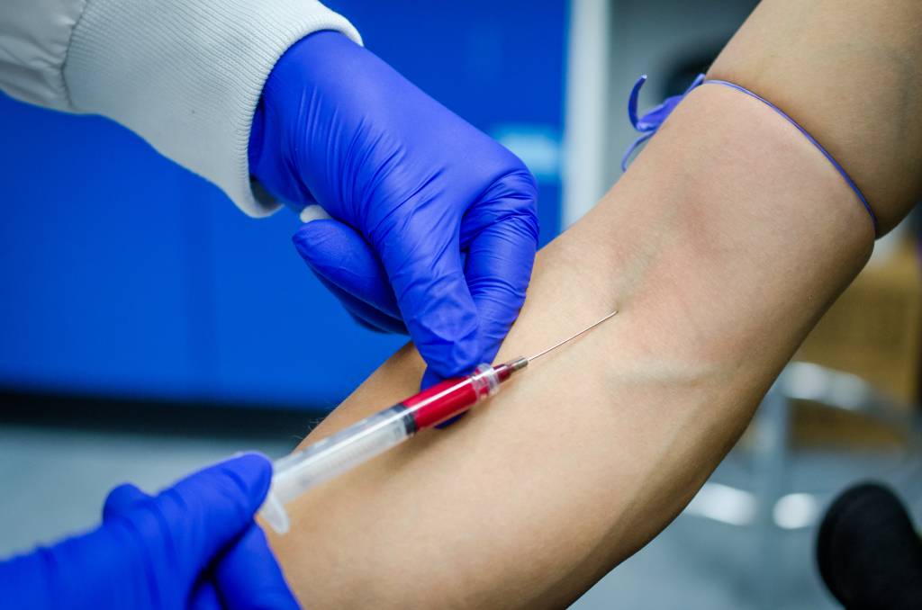 Worse Pain After PRP Injection? How SoftWave May Help